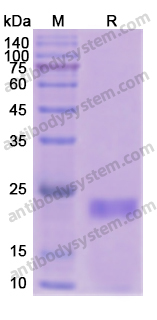 Recombinant Human CDK5 Protein, N-His