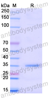 Recombinant Human CDK5 Protein, N-His