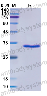 Recombinant Human HSF1 Protein, N-His
