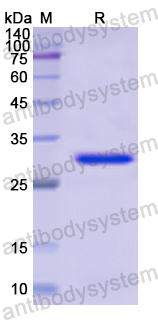 Recombinant Human SORD Protein, N-His