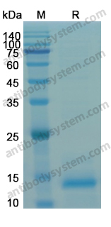 Recombinant Human CD129/IL9R Protein, N-His