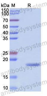 Recombinant Human CD125/IL5RA Protein, N-His