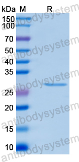 Recombinant Human MYL7 Protein, N-His-SUMO