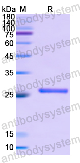 Recombinant Human MYT1 Protein, N-His