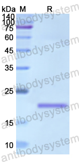 Recombinant Human HMGCS1 Protein, N-His