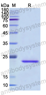 Recombinant Human IL1RL1/ST2 Protein, N-His