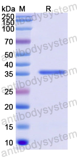 Recombinant Human IL1RL1/ST2 Protein, N-His