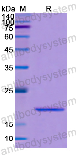 Recombinant Human CACNA1D Protein, N-His