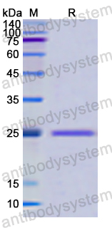 Recombinant Human PFKP Protein, N-His