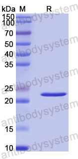 Recombinant Human EWSR1 Protein, N-His-SUMO