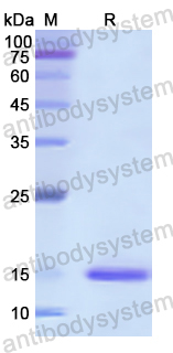 Recombinant Human ROR1 Protein, N-His
