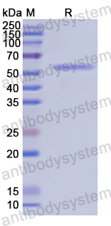 Recombinant Human ROR2 Protein, N-GST