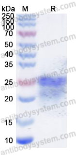 Recombinant Human TAGLN Protein, N-His