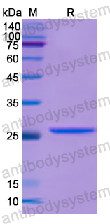 Recombinant Human GUCY1B1 Protein, N-His