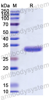 Recombinant Human PRKCE Protein, N-His