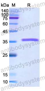 Recombinant Human RHD Protein, N-GST