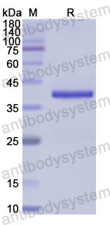 Recombinant Human OGDH Protein, N-His