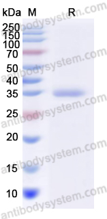 Recombinant Human CD269/TNFRSF17/BCMA Protein, N-His-KSI