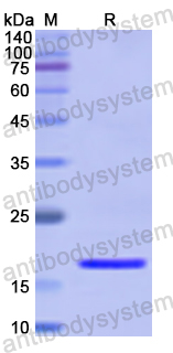 Recombinant Human CENPE Protein, N-His