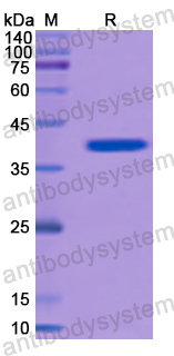 Recombinant Human BDH1 Protein, N-His