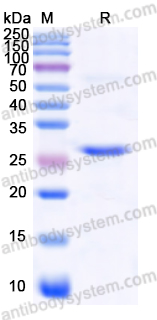 Recombinant Human COL7A1 Protein, N-His