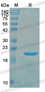 Recombinant Human APBA1 Protein, N-His