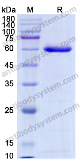Recombinant Human DSG1 Protein, N-His