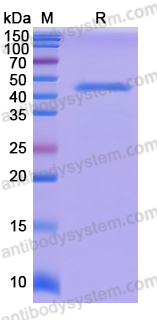 Recombinant Human DSC2 Protein, N-His
