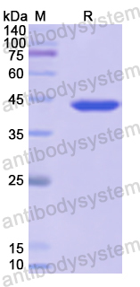 Recombinant Human PAX5 Protein, N-His