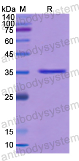 Recombinant Human IRF8 Protein, N-His