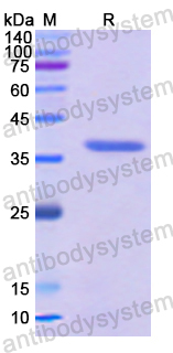 Recombinant Human MAP2K1 Protein, N-His
