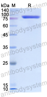 Recombinant Human CD202b/TEK Protein, N-His