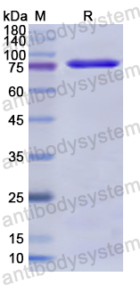 Recombinant Human FKBP4 Protein, N-GST