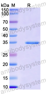 Recombinant Human TOP2B Protein, N-His