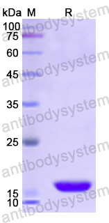 Recombinant Human CFHR3 Protein, N-His