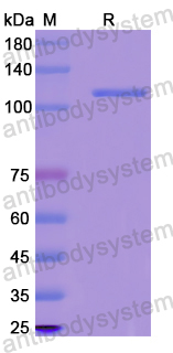 Recombinant Human DST/Dystonin/eBPAG1 Protein, N-GST & C-His