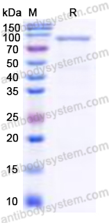 Recombinant Human DST/Dystonin Protein, N-His