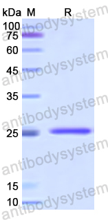 Recombinant Human GSTM4 Protein, N-His