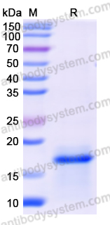Recombinant Human CAV1 Protein, N-His