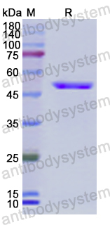 Recombinant Human ACY1 Protein, N-His