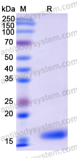 Recombinant Human LMNB2 Protein, N-His