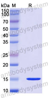 Recombinant Human LMNB2 Protein, N-His