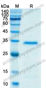 Recombinant Human CD87/PLAUR/uPAR Protein, N-His