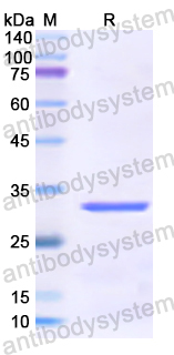 Recombinant Human TAP1 Protein, N-His