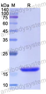 Recombinant Human COL10A1 Protein, N-His