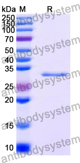 Recombinant Human RELA Protein, C-His