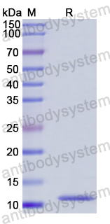 Recombinant Human UBXN1 Protein, N-His
