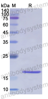 Recombinant Human KRT17 Protein, N-His