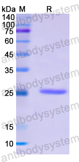 Recombinant Human NOTCH2 Protein, N-His