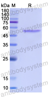 Recombinant Human PRKCQ Protein, N-GST